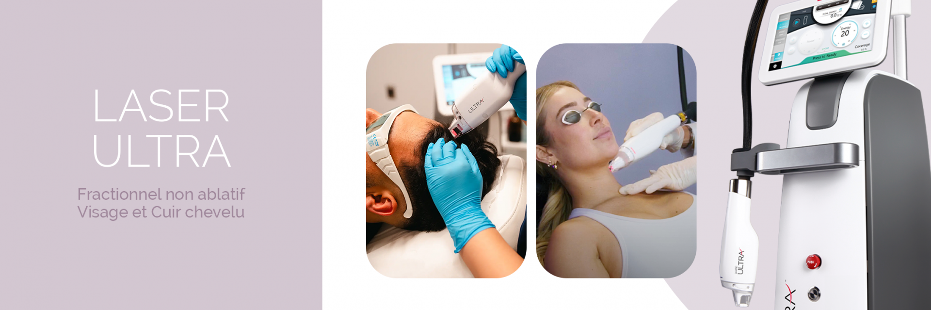 Laser Ultra