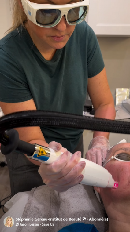 Stepanie Gareau Boucherville Ultra Laser Cynosure